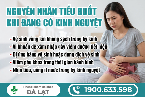 Hình ảnh minh họa